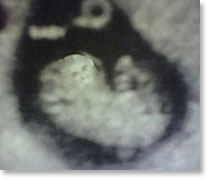 actual picture of Baby Mahoney in utero